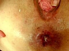 Arrombando Meu Cuzinho Com Anal Gaping E Assfucking Selvagem 😈🔥