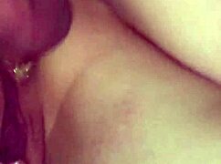 anal prone bone close up view