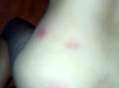 Part 5: Falling Off Motorcycle Leads to Adventure