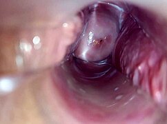 Ever Seen an Orgasm Right Inside a Vagina Up Close?