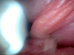 Endoscope Reveals Sensitive Penis Areas In Educational Video