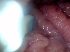 Endoscope Reveals Sensitive Penis Areas In Educational Video