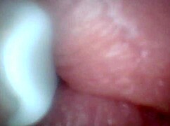 Endoscope Reveals Sensitive Penis Areas In Educational Video