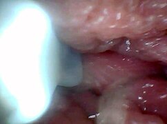 Endoscope Reveals Sensitive Penis Areas In Educational Video