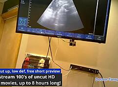 nova maverick plays with ultrasound in hospital pov