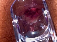 Intense Anal Speculum Gaping On Big Ass Slut With Hairy Pussy