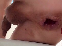 My Anal Lubricant Leaks From Prolapse Again