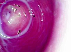 camera deep inside the wet pussy captures intense orgasm