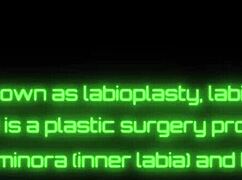 Does Scarlett Johnson's Pussy Get Tightened Up?