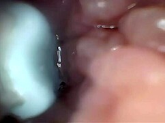 ripping clothes for gaping pussy creampie endoscope stretch