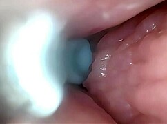 ripping clothes for gaping pussy creampie endoscope stretch