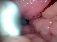 ripping clothes for gaping pussy creampie endoscope stretch