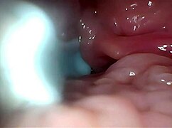 ripping clothes for gaping pussy creampie endoscope stretch